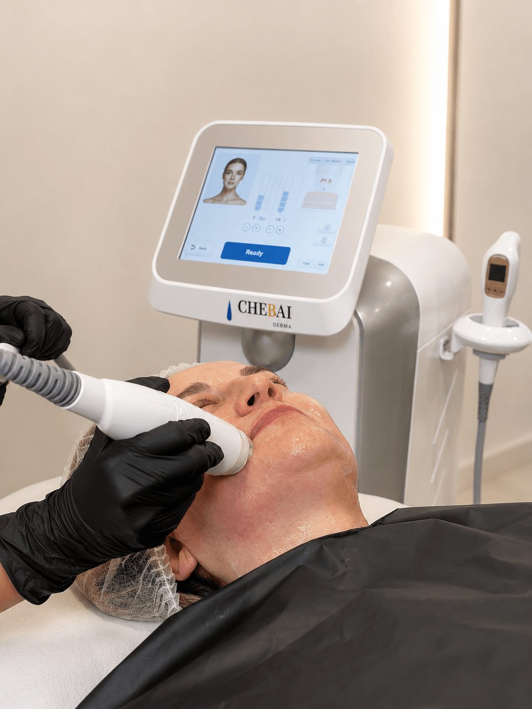 Definición mandibular con ULTRALIFT